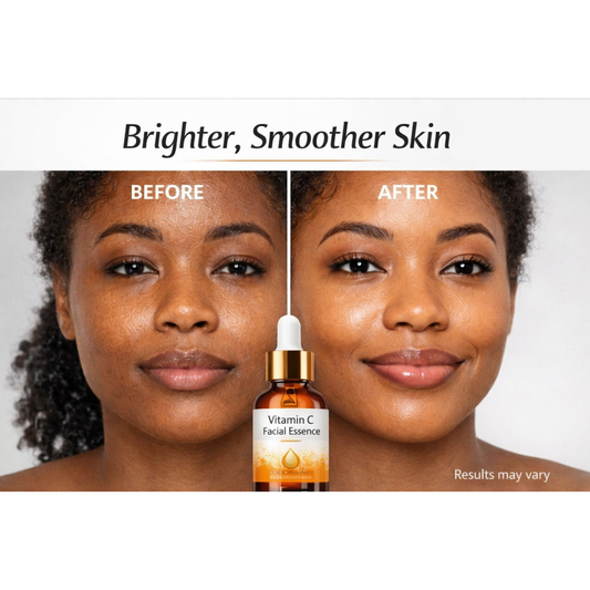 Vitamin C Glow Serum – Brightens Skin, Fades Fine Lines & Deeply Hydrates